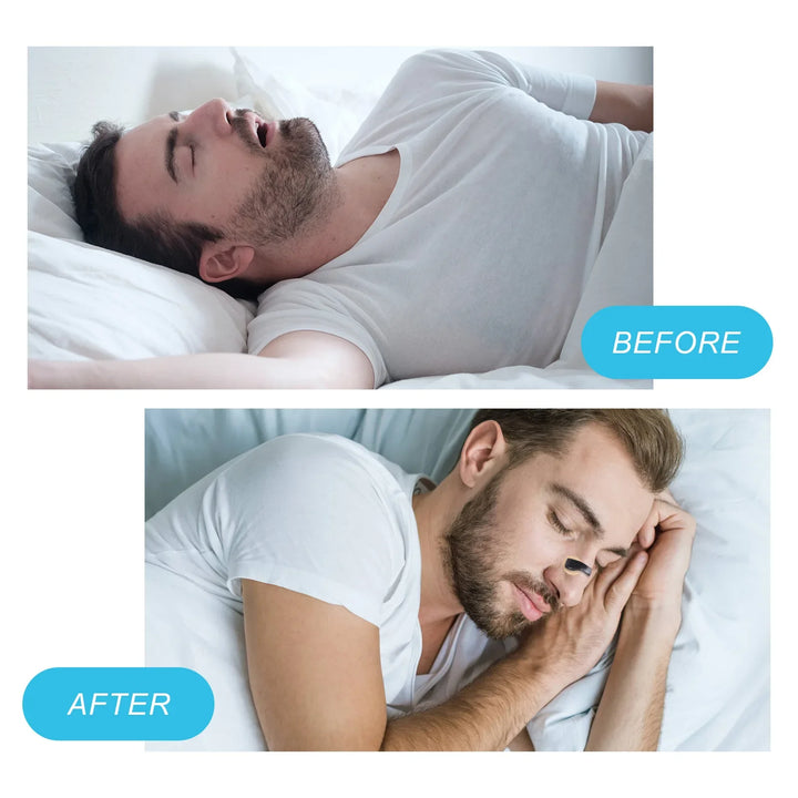 Nose Breathing Patches Suction Iron Tabs Magnetic Nasal Strips Increase